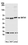 Detection of human SNTA1 by western blot.