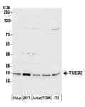 Detection of human and mouse TMED2 by western blot.