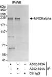 Detection of human MRCKalpha by western blot of immunoprecipitates.