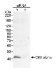 Detection of human CKII Alpha by western blot.
