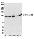 Detection of human and mouse NF-kappaB2 by western blot.