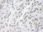 Detection of mouse NONO by immunohistochemistry.