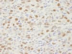 Detection of mouse MSH2 by immunohistochemistry.