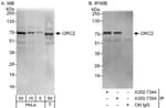 Detection of human ORC2 by western blot and immunoprecipitation.