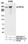 Detection of human BRCA2 by western blot of immunoprecipitates.