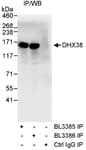 Detection of human DHX38 by western blot of immunoprecipitates.