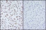 Detection of mouse Phospho SMC1 (Ser 966) by immunohistochemistry.