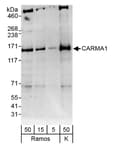 Detection of human CARMA1 by western blot.