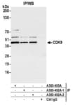 Detection of human CDK9 by western blot of immunoprecipitates.