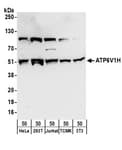 Detection of human and mouse ATP6V1H by western blot.