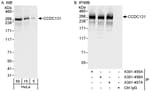 Detection of human CCDC131 by western blot and immunoprecipitation.