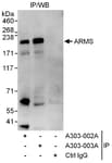 Detection of human ARMS by western blot of immunoprecipitates.