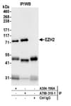 Detection of human EZH2 by western blot of immunoprecipitates.