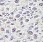 Detection of mouse GNL3 by immunohistochemistry.