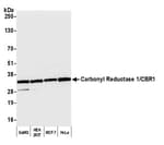 Detection of human Carbonyl Reductase 1/CBR1 by western blot.