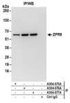 Detection of human ZPR9 by western blot of immunoprecipitates.
