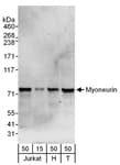 Detection of human Myoneurin by western blot.