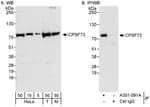 Detection of human and mouse CPSF73 by western blot (h&amp;m) and immunoprecipitation (h).