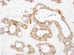 Detection of human DLST by immunohistochemistry.