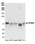 Detection of human and mouse MTMR2 by western blot.