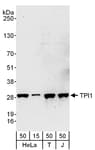 Detection of human TPI1 by western blot.