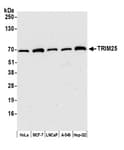 Detection of human TRIM25 by western blot.