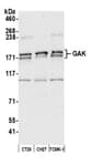 Detection of mouse GAK by western blot.