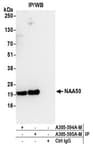 Detection of human NAA50 by western blot of immunoprecipitates.