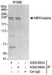 Detection of human MRCKalpha by western blot of immunoprecipitates.