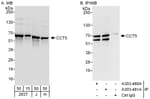 Detection of human CCT5 by western blot and immunoprecipitation.