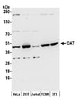 Detection of human and mouse OAT by western blot.