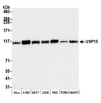 Detection of human and mouse USP15 by western blot.