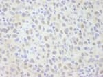 Detection of mouse NCOA62 by immunohistochemistry.