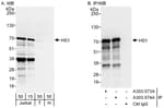 Detection of human HS1 by western blot and immunoprecipitation.