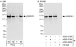 Detection of human LRRFIP1 by western blot and immunoprecipitation.