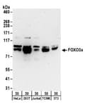 Detection of human and mouse FOXO3a by western blot.