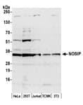 Detection of human and mouse NOSIP by western blot.