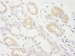 Detection of human eIF2A by immunohistochemistry.