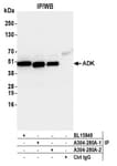 Detection of human ADK by western blot of immunoprecipitates.