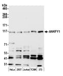 Detection of human and mouse ANKFY1 by western blot.