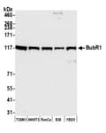 Detection of mouse and rat BubR1 by western blot.