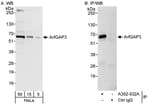 Detection of human ArfGAP3 by western blot and immunoprecipitation.