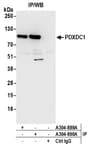 Detection of human PDXDC1 by western blot of immunoprecipitates.