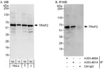 Detection of human TRAF2 by western blot and immunoprecipitation.