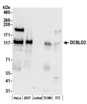 Detection of human and mouse DCBLD2 by western blot.