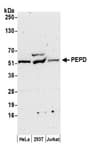 Detection of human PEPD by western blot.