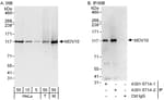 Detection of human and mouse MOV10 by western blot (h&amp;m) and immunoprecipitation (h).