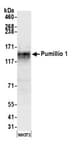 Detection of mouse Pumillio 1 by western blot.