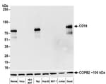 Detection of human CD19 by western blot.