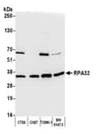 Detection of mouse RPA32 by western blot.